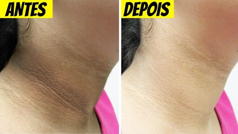 Como Limpar o Pescoço Preto de Forma Eficiente