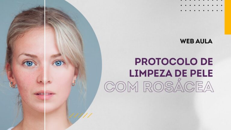 Como Limpar a Pele do Rosto com Rosácea