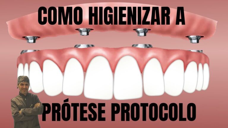 Guia Prático para Limpar Prótese Esquelética