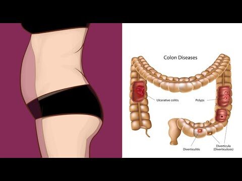 Limpeza Intestinal: Dicas para Emagrecer Eficazmente