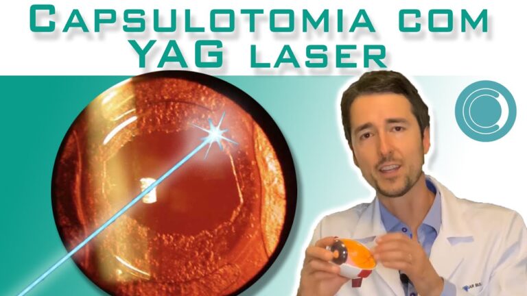 Limpeza de Lente a Laser: Preços e Benefícios