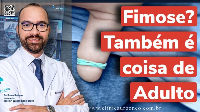 Como Limpar a Secreção da Glande em Casos de Fimose
