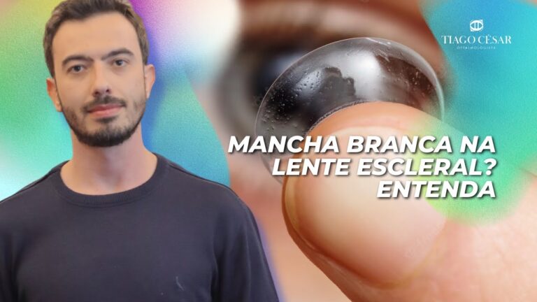 Eliminando Manchas Brancas: Melhor Produto para Limpar Lentes de Contato