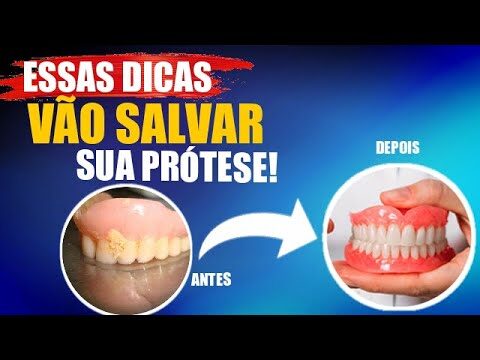Como Limpar Prótese Dentária com Tártaro de Forma Eficiente