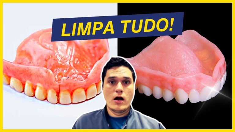 Guia Prático para Limpar Corretamente a Prótese Dentária