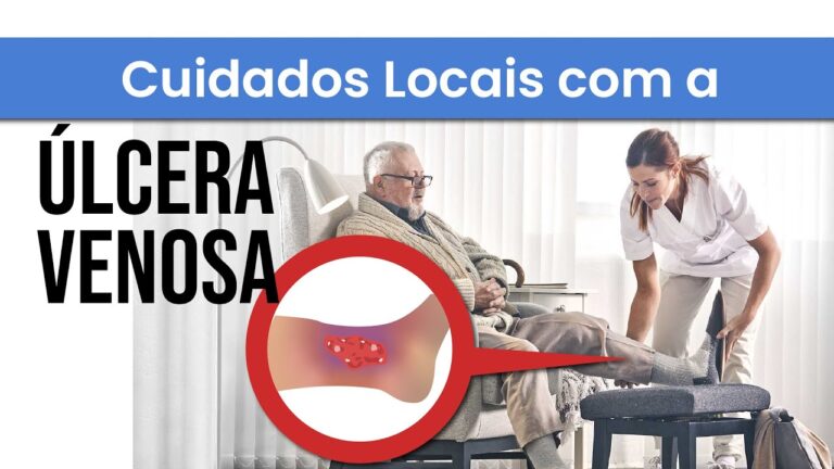 Como Limpar Úlcera Varicosa de Forma Eficiente