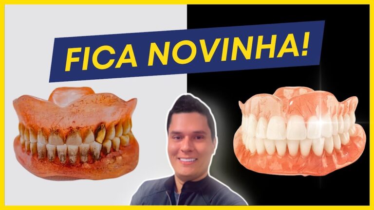 Métodos Eficazes para Limpar Dentadura Encardida