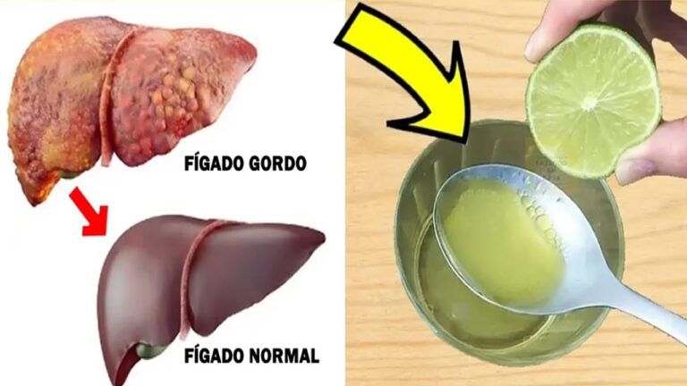 Benefícios de Limpar o Fígado com Limão e Azeite