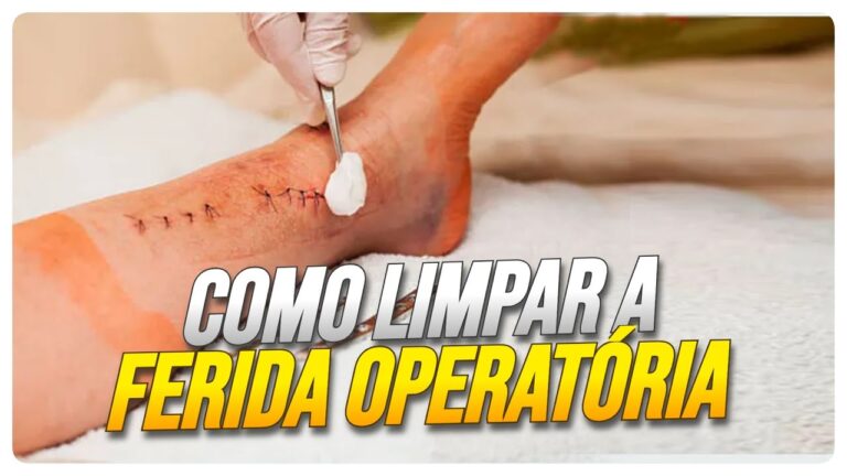 Como Limpar Cicatrizes com Soro Fisiológico