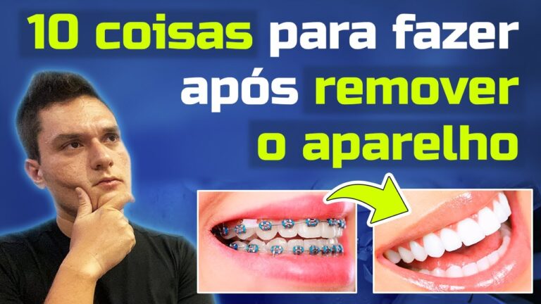 Como Limpar os Dentes Após Remoção do Aparelho