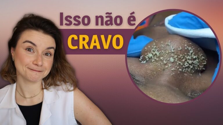 Eliminando Pontos Pretos do Rosto: Dicas Eficazes