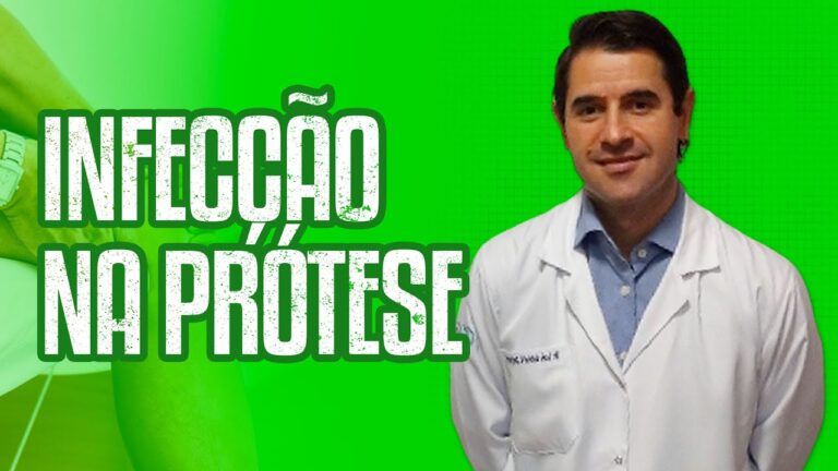 Guia Pr&aacute;tico para Limpar sua Pr&oacute;tese de Joelho