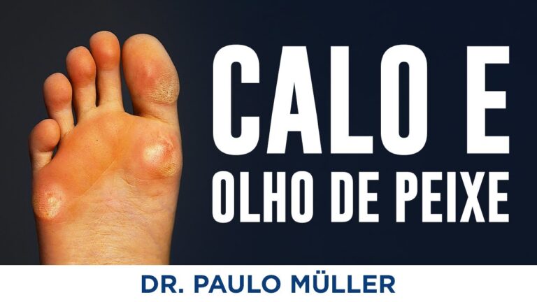 Como Limpar Cal&ccedil;ado Contaminado por Verrugas Plantares