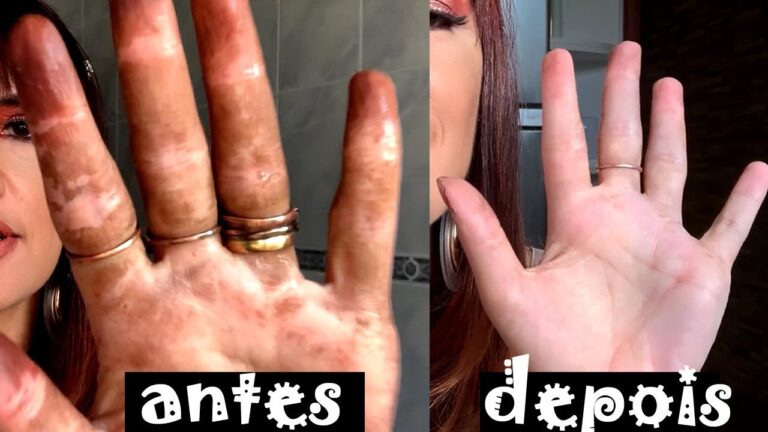 Dicas Eficazes para Remover Tinta de Cabelo das M&atilde;os