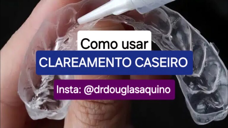 Guia Prático para Limpar Goteiras de Branqueamento