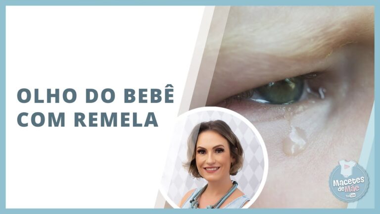 Como Limpar o Beb&ecirc; com Remela de Forma Eficiente