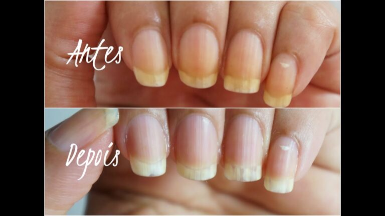 Métodos Eficazes para Limpar Unhas Amareladas