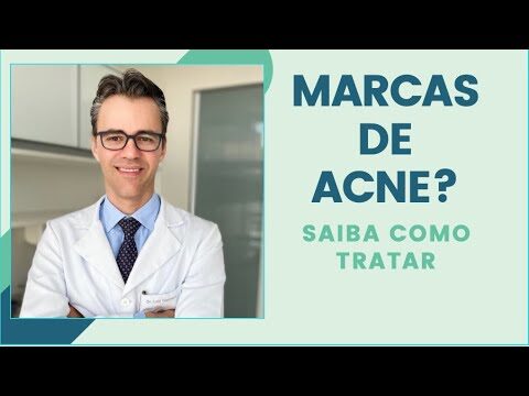 Dicas Eficazes para Limpar Manchas de Acne