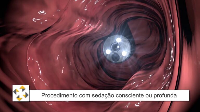 Limpeza Intestinal para Endoscopia da Pr&oacute;stata: Como Fazer?