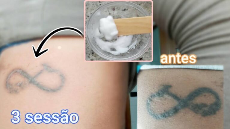 Limpeza Eficaz de Tatuagens com Soro Salino