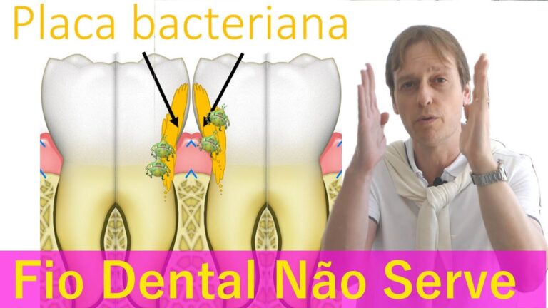 Dicas Eficazes para Limpar o Meio dos Dentes