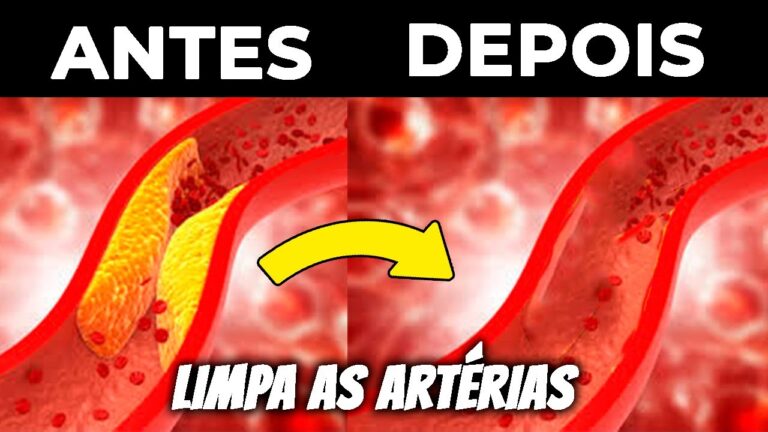 Métodos Eficazes para Limpar Artérias Entupidas